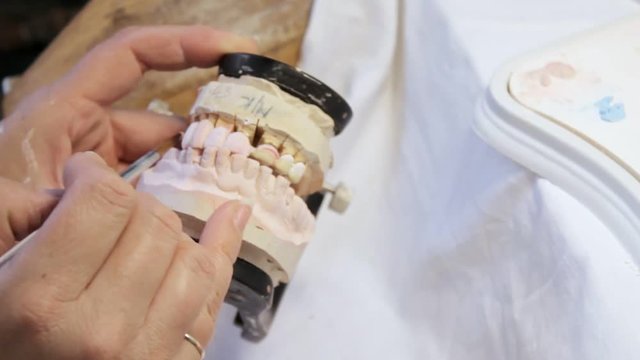 Dentist prosthetist paints denture jaw