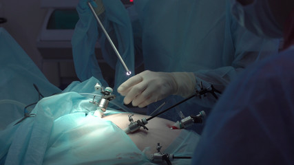 Operation using laparoscopic equipment. Surgeons team. Hospital.