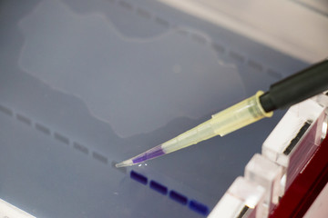 Agarose gel electrophoresis is a method of gel electrophoresis used in biochemistry, molecular...