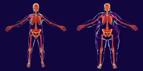 Obesity problem conceptual image, 3D illustration showing normal wieght man and normal skeleton inside obese male body