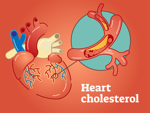 Heart cholesterol concept vector illustration