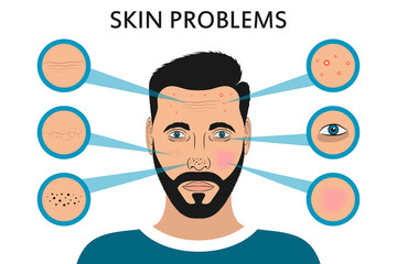 Male face skin problems. Acne and pimples, black spots, redness, dryness, circles under the eyes and wrinkles. Vector illustration for cosmetic brochure or banner, poster.