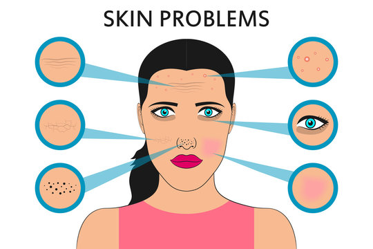Female face skin problems. Acne and pimples, black spots, redness, dryness, circles under the eyes and wrinkles. Vector illustration for cosmetic brochure or banner, poster.
