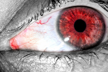 Human eye with red tight veins on protein macro close-up texture background