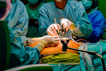 Heart surgery, atmosphere in the operating room