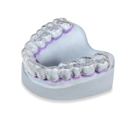 Fertige Zahnschiene auf  Gebissabdruck Dentalmodell