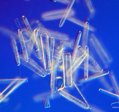 Dark field light micrograph  of freshwater pennate diatoms