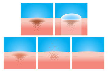 age spots of an elderly human vector