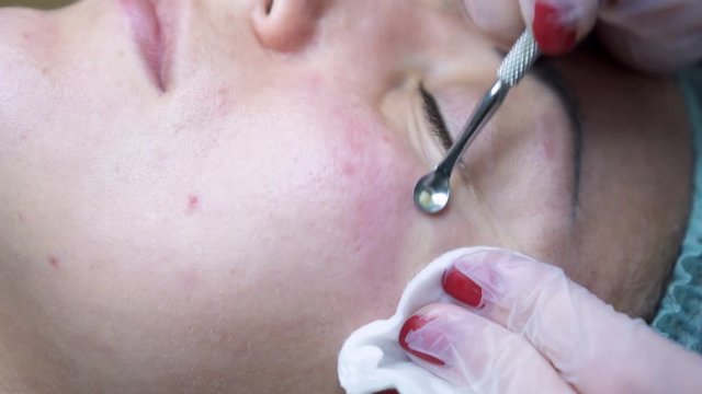 Mechanical facial cleansing in the beauty salon