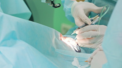 Hands of ophtalmology surgeons and assistants with ophtalomological surgery tools during surgical treatment. Indoor. Close up