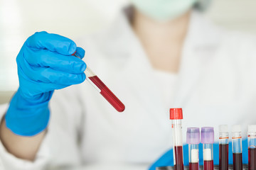 Female Technician holding blood tube test, a rack of  blood samples Tubes of patients in laboratory in the hospital.