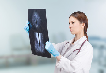  Thoughtful female doctor looking at the Mammogram film image.
