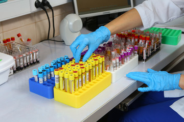 Hands sort the test tubes with blood tests