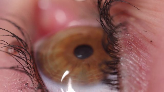 Slow motion close up woman administers eye drops to alleviate irritated dry eye