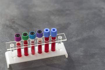 rack of blood test on white support on grey slate bacground