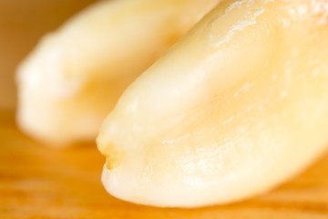 Root on the teeth of a man