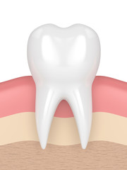 3d render of tooth in gums