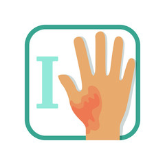 Informative illustration of first-degree burn. Damaged hand with redness, no blisters. Injury concept. Flat vector design for infographic card, brochure or poster