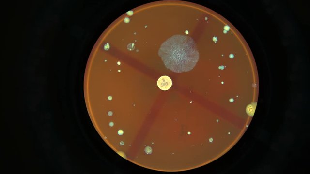 Growth Colony of microbes and pathogenic fungi in petri dish