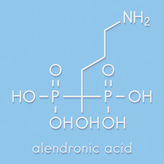 Alendronic acid (alendronate, bisphosphonate class) osteoporosis drug molecule. Skeletal formula.