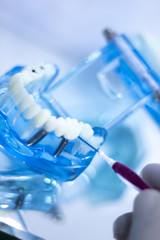 Interdental teeth cleaning