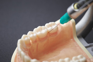 Tooth model