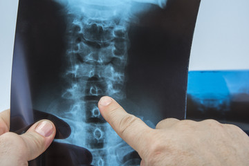 Doctor pointing out on diagnose on x-ray © OttoPles