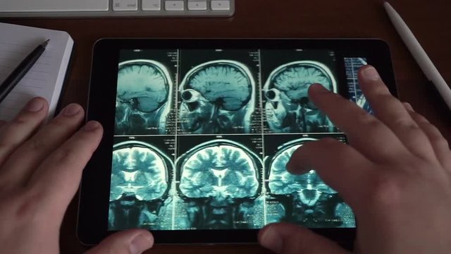 Doctor looking at tablet on his table with MRI brain scan or x-ray, modern medical diagnostic concept, top view