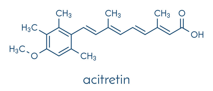 Acitretin psoriasis drug molecule. Skeletal formula.
