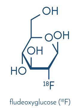 Fludeoxyglucose 18F (fluorodeoxyglucose 18F, FDG) Cancer Imaging Diagnostic Drug Molecule. Contains Radioactive Isotope Fluorine-18. Skeletal Formula.