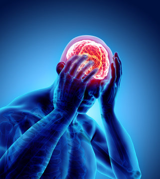3d illustration of headache human.