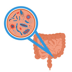 intestinal flora sign