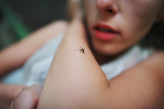 A mosquito sits on the woman's hand and sucks blood. Pain, itching, danger of infection.