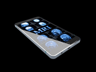 3D Illustration of Medicine concept: Smartphone with blue text MRI and X-ray of the skull on display, isolated black