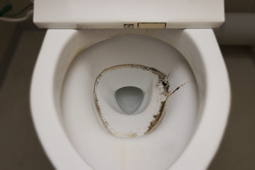 汚れたトイレの便器