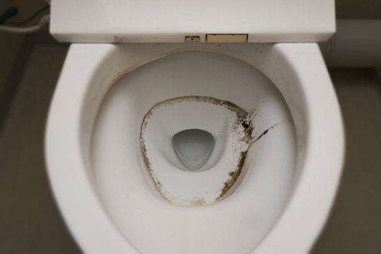 汚れたトイレの便器