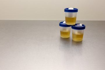 Drug Test Urinalysis