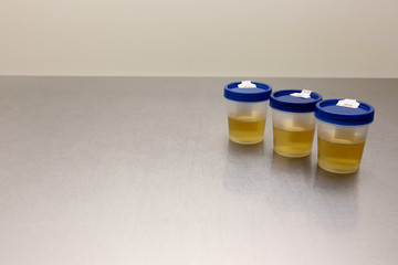 Drug Test Urinalysis