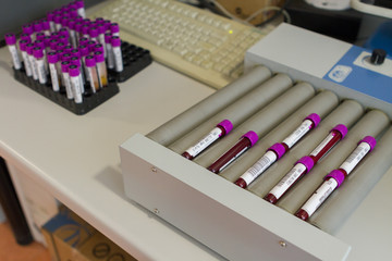 Naklejka premium Zagreb, Croatia - June 14, 2017: Blood sample tubes ready for analysis