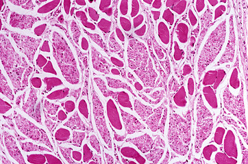 Oesophagus