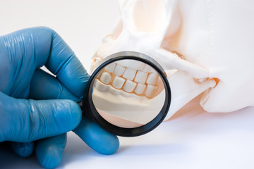 Dental, periodontal and gum disease diagnosis and treatments concept photo. Dentist or dental...