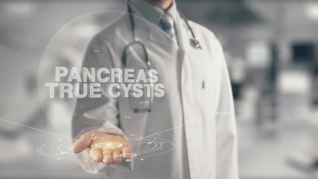 Doctor holding in hand Pancreas True Cysts