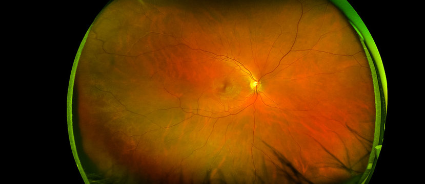 eye's retinal angle image with macula, vessels and optic disc isolated view on a black bacground. made by ultra wide fundus camera