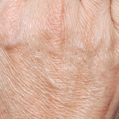 Fototapeta premium human skin texture