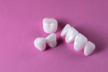 Zircon dentures on a pink background - Ceramic veneers - lumineers