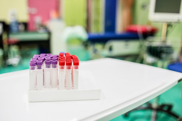 plastic laboratory tubes on a bench with filter color tone effect