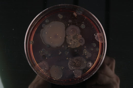  growth of microorganisms in a Petri dish, Bacteria, yeast and mold growing on an agar plate.