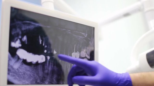 The dentist examines the panoramic X-ray of the tooth with the patient