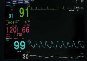 Monitor vital sign and EKG  monitor in ICU unit ,it show The waves of blood pressure, blood oxygen saturation, ECG,heart rate,respiratory rate.