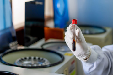 Hand holding test tube with blood plasma ready for testing in laboratory